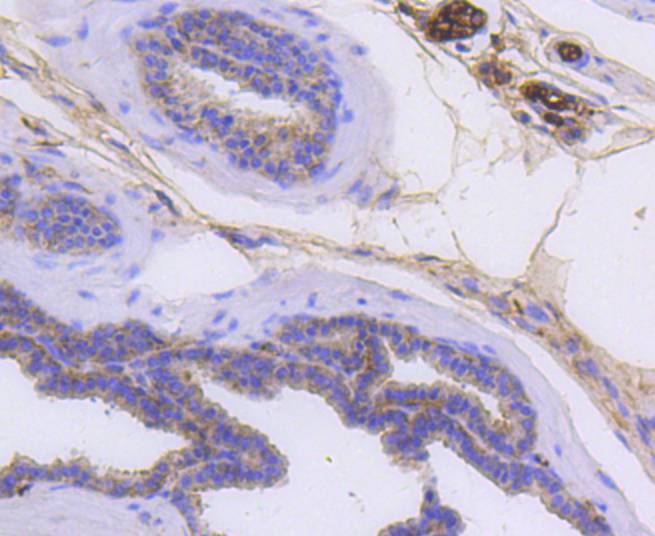 Cytokeratin 14 Rabbit mAb