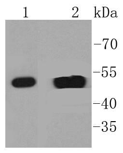 Cytokeratin 14 Rabbit mAb