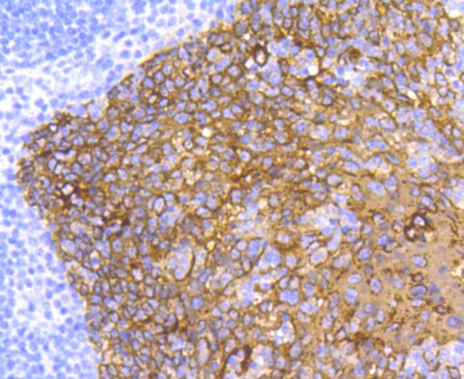 Cytokeratin 5 Rabbit mAb