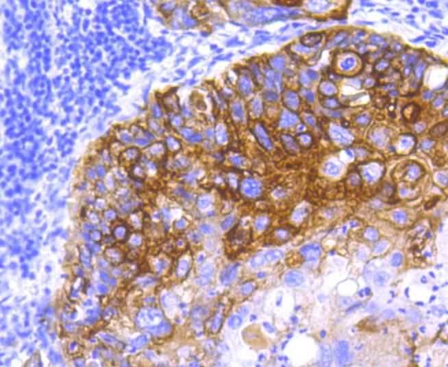 Cytokeratin 5 Rabbit mAb