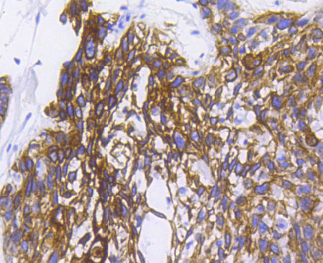 Cytokeratin 5 Rabbit mAb