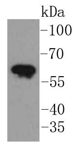 Cytokeratin 5 Rabbit mAb