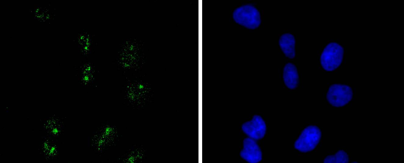 Wilms Tumor Protein Rabbit mAb