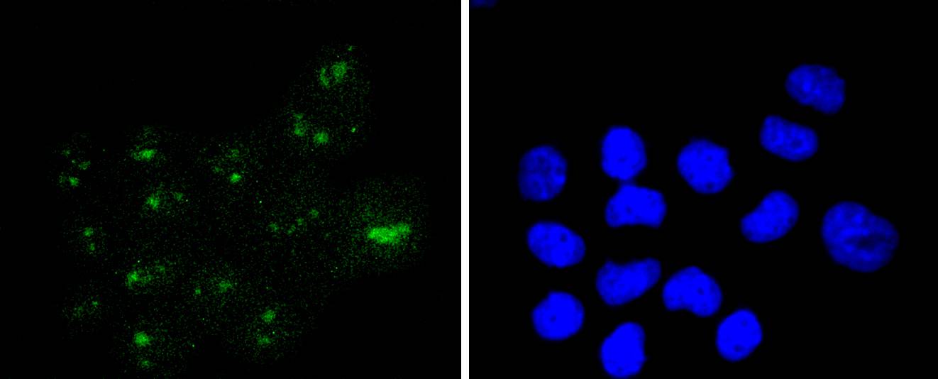 Wilms Tumor Protein Rabbit mAb