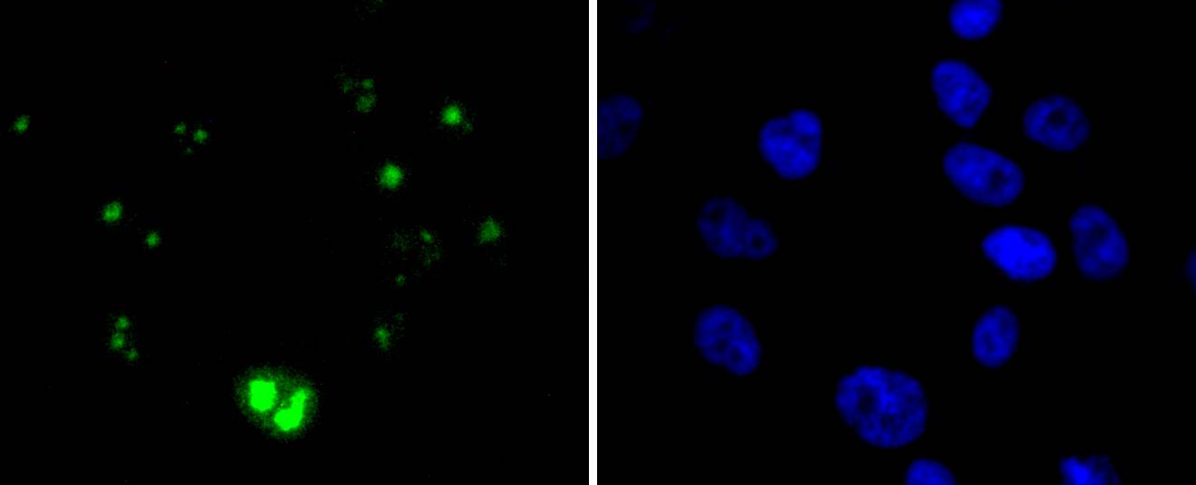 Wilms Tumor Protein Rabbit mAb