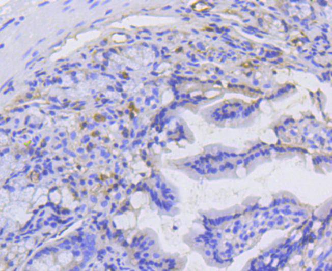 alpha 1 Catenin Rabbit mAb