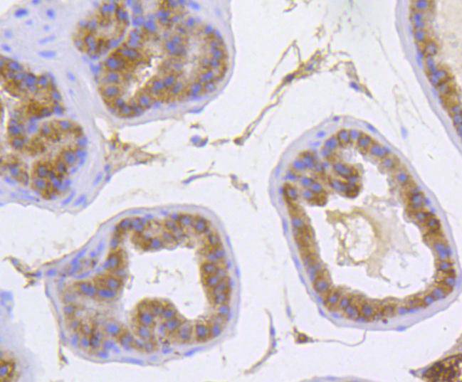 alpha 1 Catenin Rabbit mAb