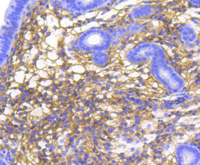 alpha 1 Catenin Rabbit mAb