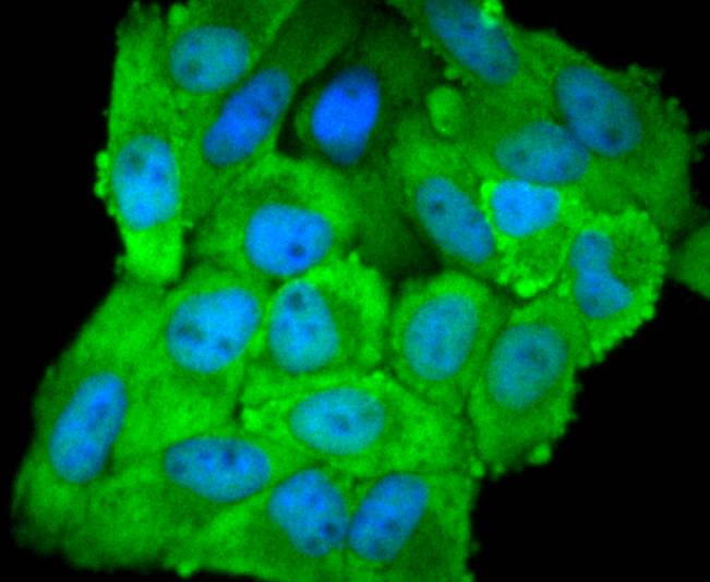 eIF5A Rabbit mAb