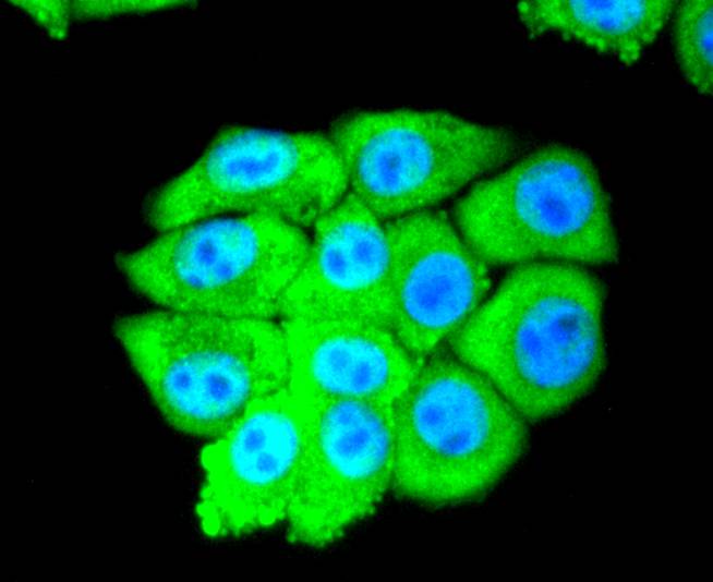 eIF5A Rabbit mAb