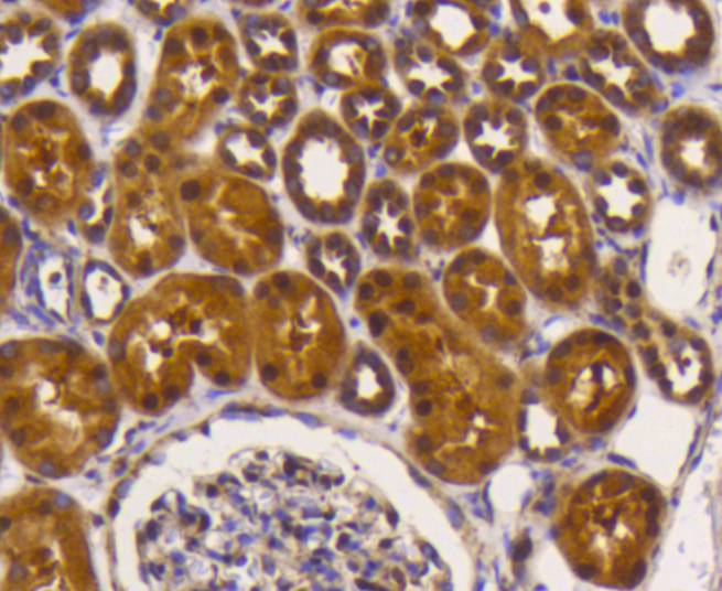 eIF5A Rabbit mAb