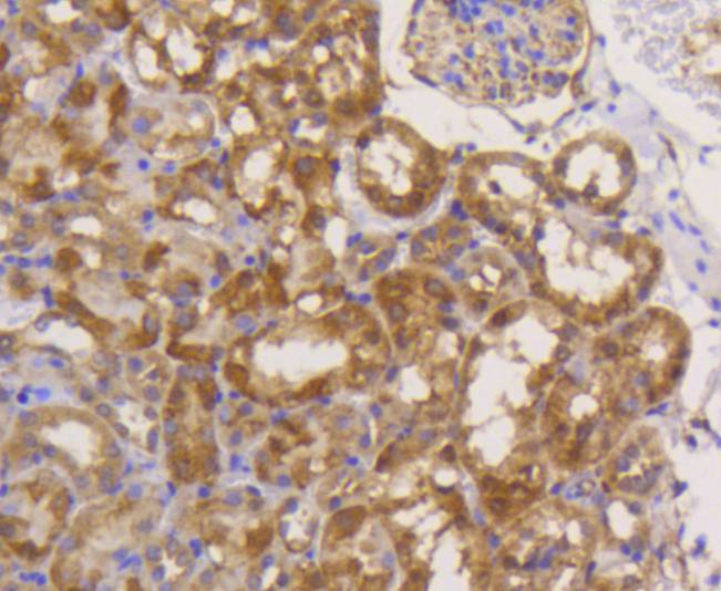 eIF5A Rabbit mAb