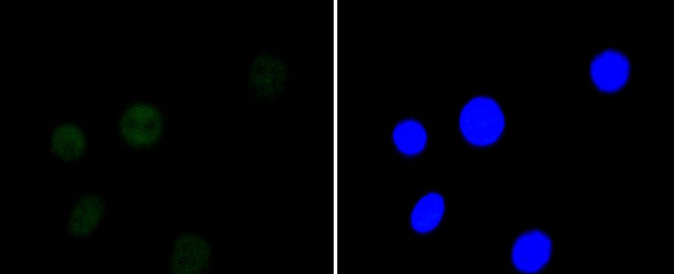 HDAC3 Rabbit mAb