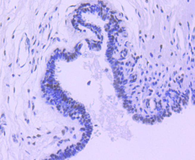 HDAC3 Rabbit mAb