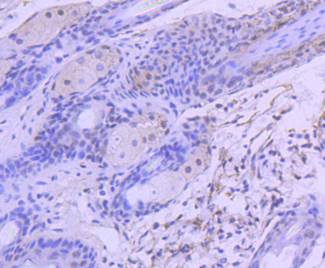 HDAC3 Rabbit mAb