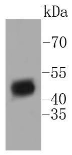 HDAC3 Rabbit mAb