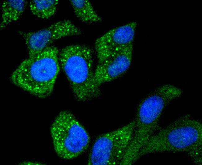 Asparagine synthetase Rabbit mAb