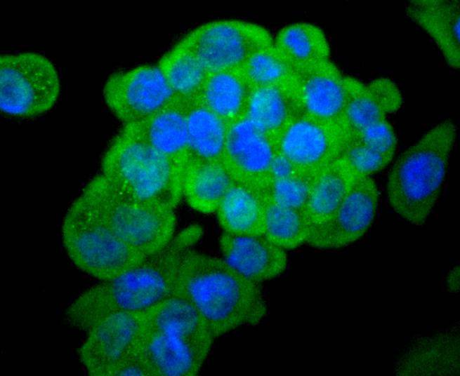 Asparagine synthetase Rabbit mAb