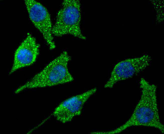 Asparagine synthetase Rabbit mAb