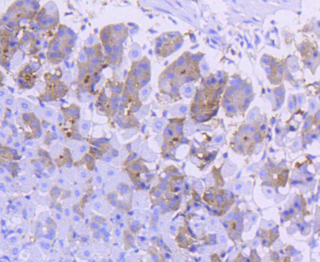 Asparagine synthetase Rabbit mAb