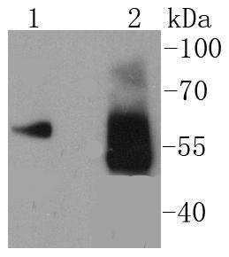 Asparagine synthetase Rabbit mAb