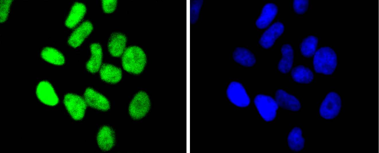 Chk2 Rabbit mAb