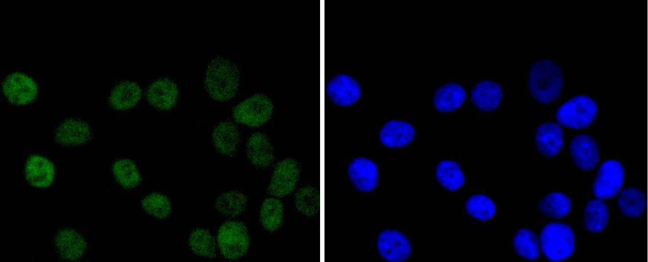 Chk2 Rabbit mAb