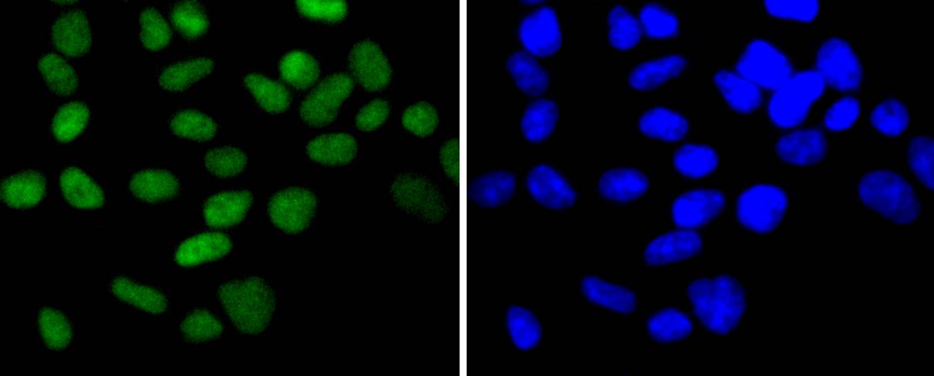 Chk2 Rabbit mAb