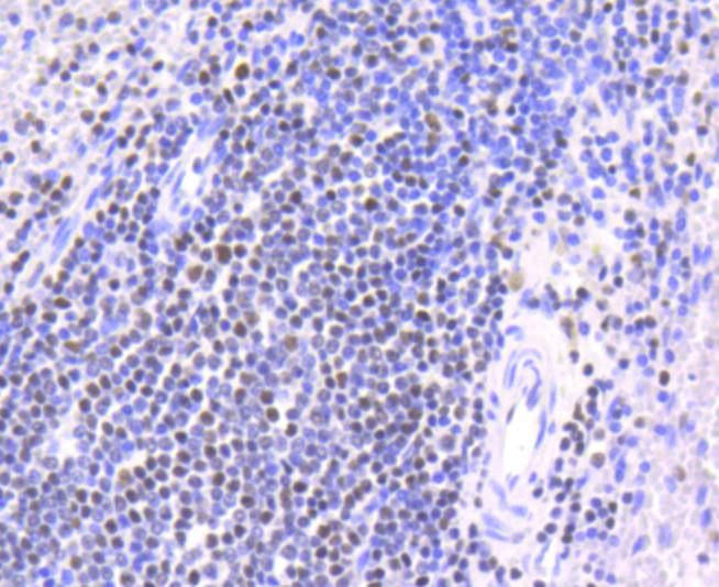 Chk2 Rabbit mAb