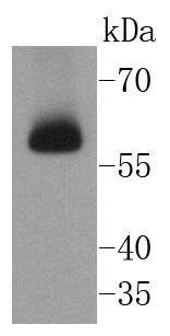 Chk2 Rabbit mAb