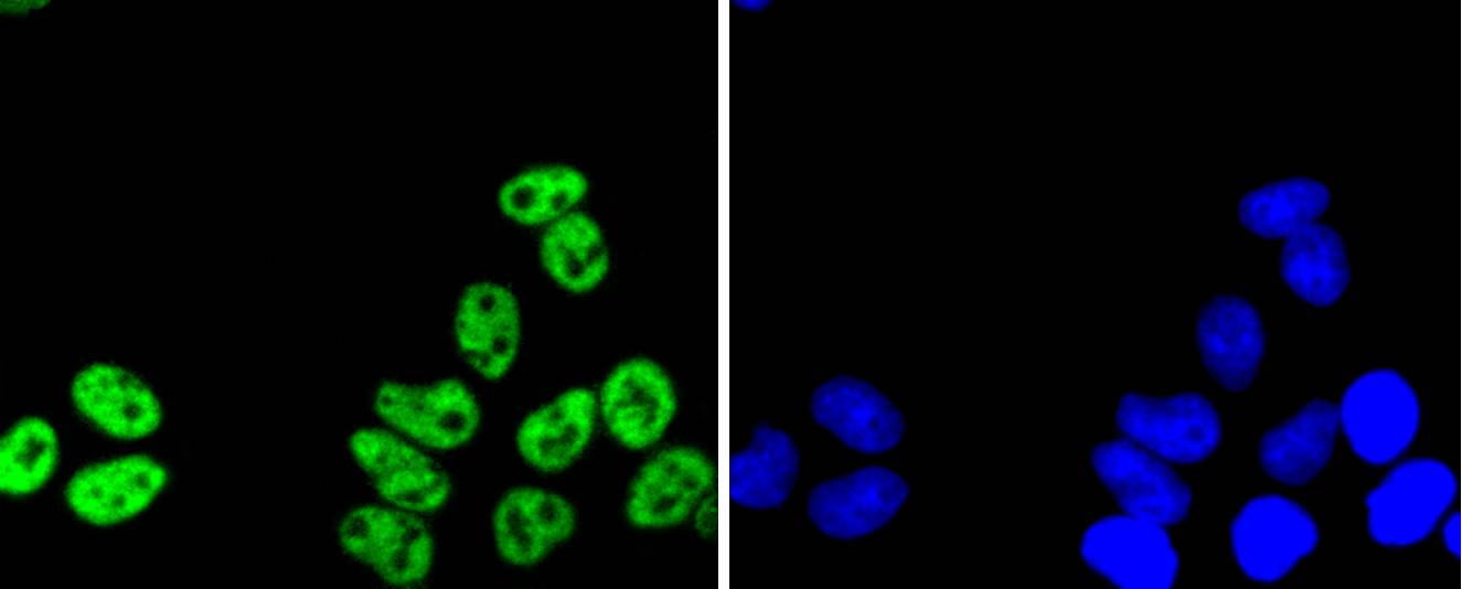 PRP19 Rabbit mAb