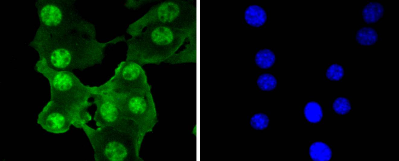 PRP19 Rabbit mAb