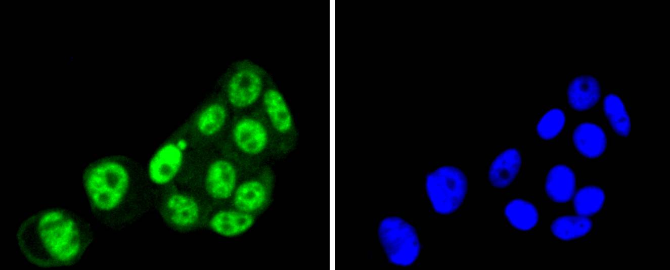 PRP19 Rabbit mAb