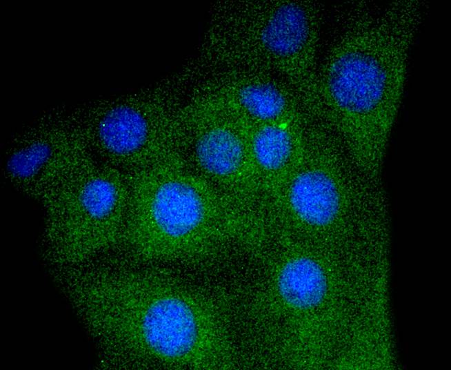 Myoglobin Rabbit mAb