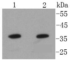 Annexin A10 Rabbit mAb