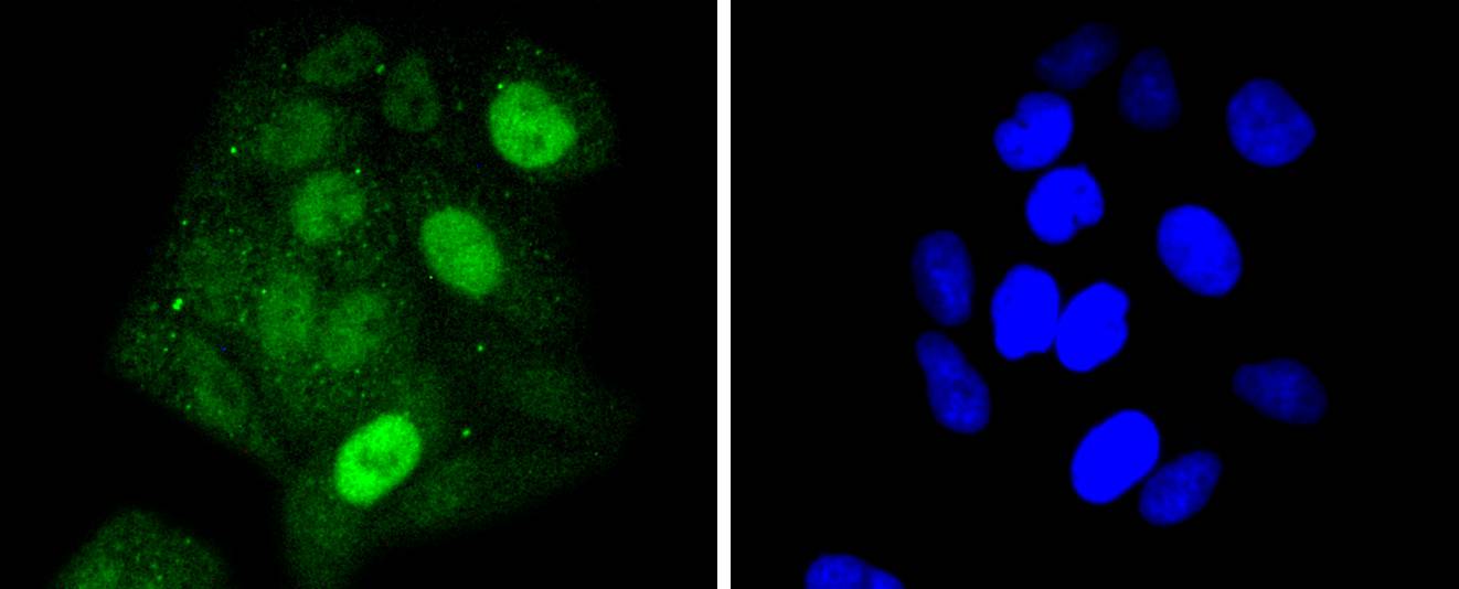 STAT5a Rabbit mAb