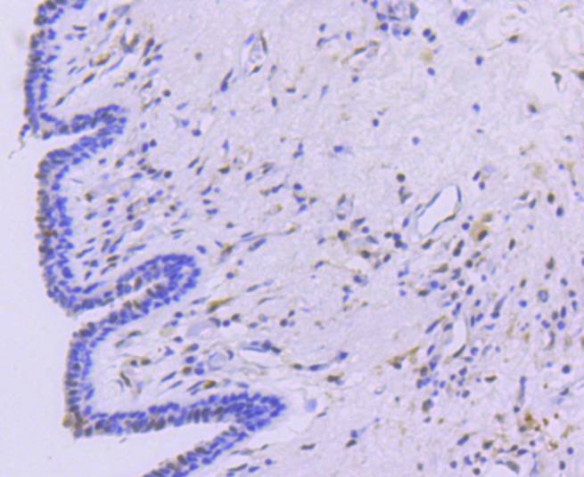 STAT5a Rabbit mAb