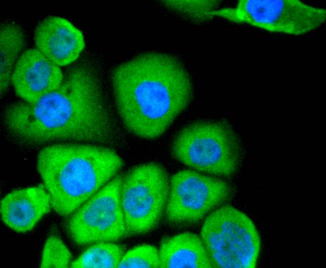 CD13 Rabbit mAb