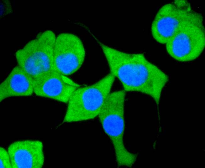 CD13 Rabbit mAb