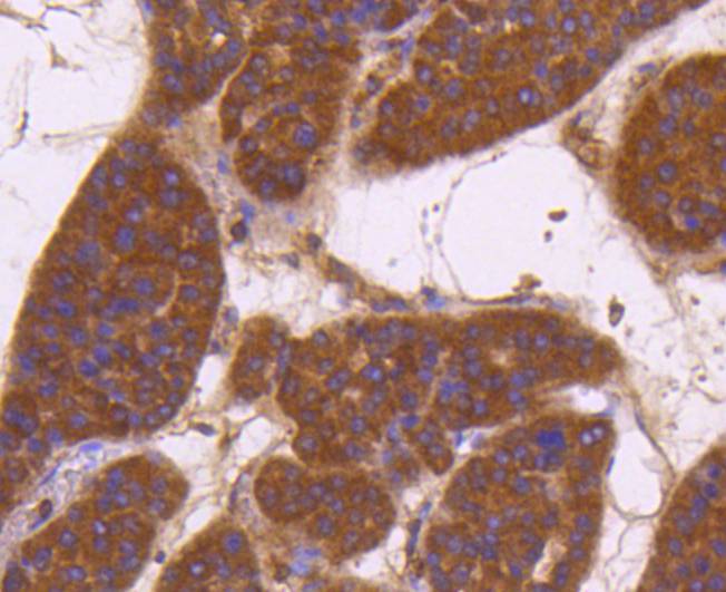 CD13 Rabbit mAb