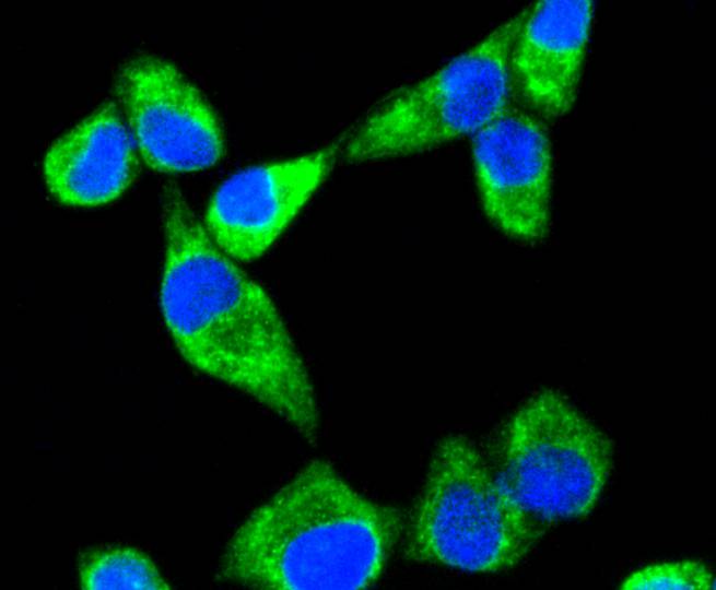 Sonic Hedgehog Protein/SHH(C-Product) Rabbit mAb