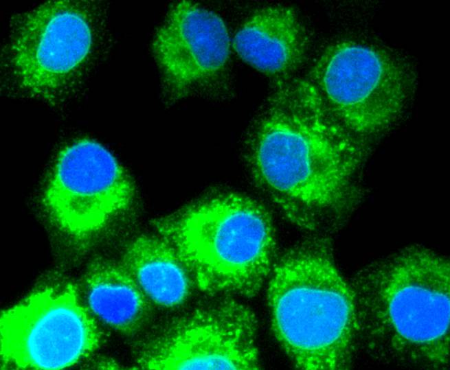 Sonic Hedgehog Protein/SHH(C-Product) Rabbit mAb