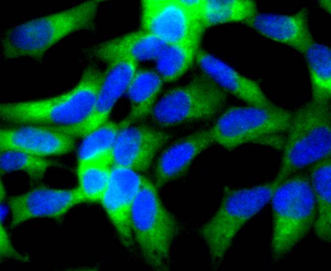 Sonic Hedgehog Protein/SHH(C-Product) Rabbit mAb