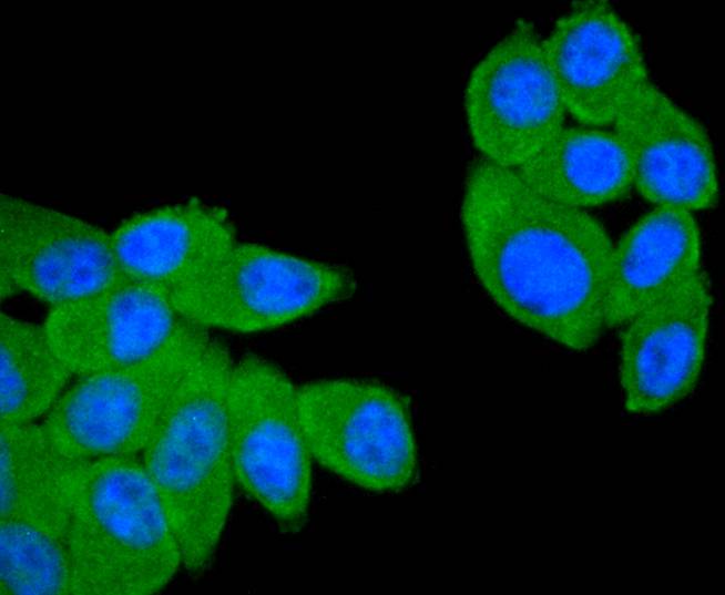 CD21 Rabbit mAb