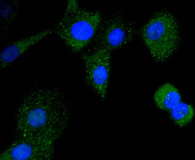 CD21 Rabbit mAb