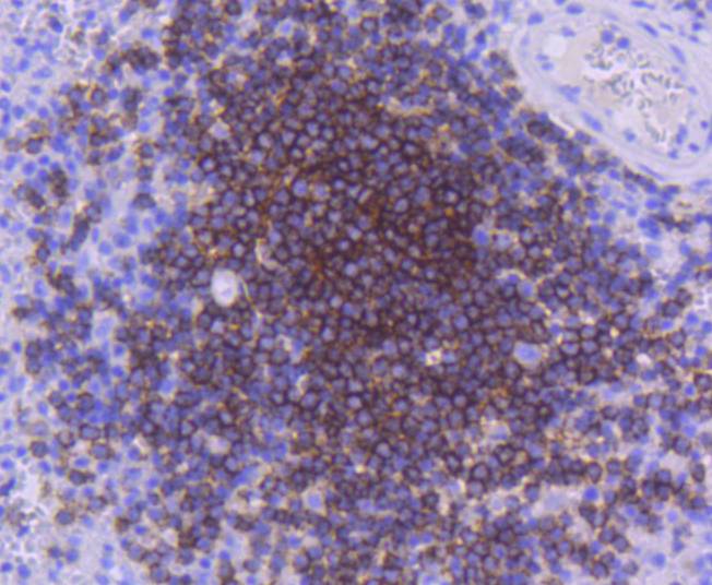 CD21 Rabbit mAb