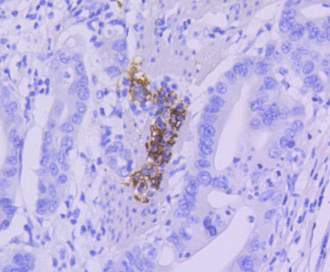 CD21 Rabbit mAb