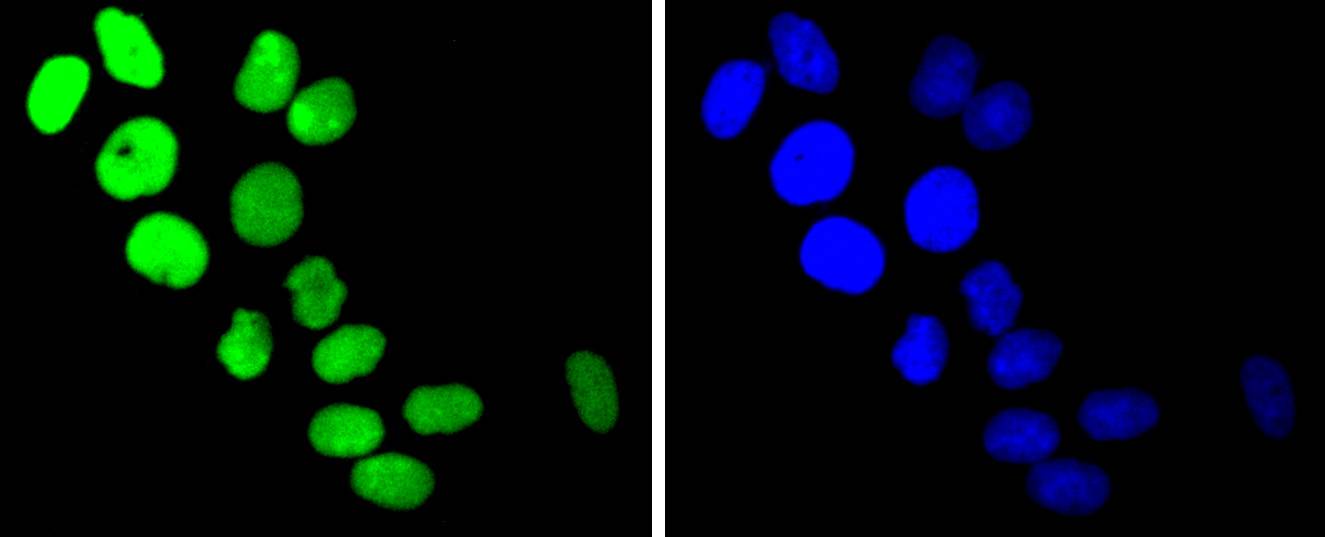 Topoisomerase I Rabbit mAb