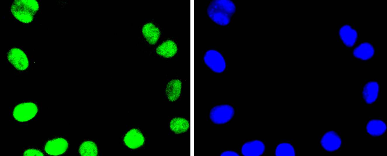 Topoisomerase I Rabbit mAb