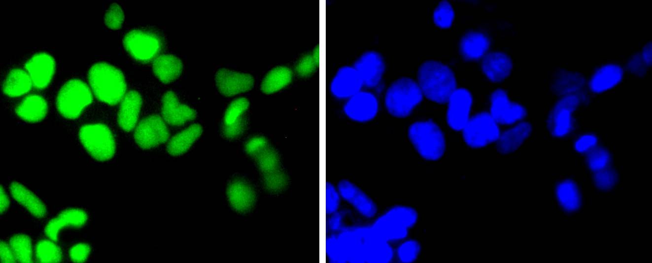 Topoisomerase I Rabbit mAb